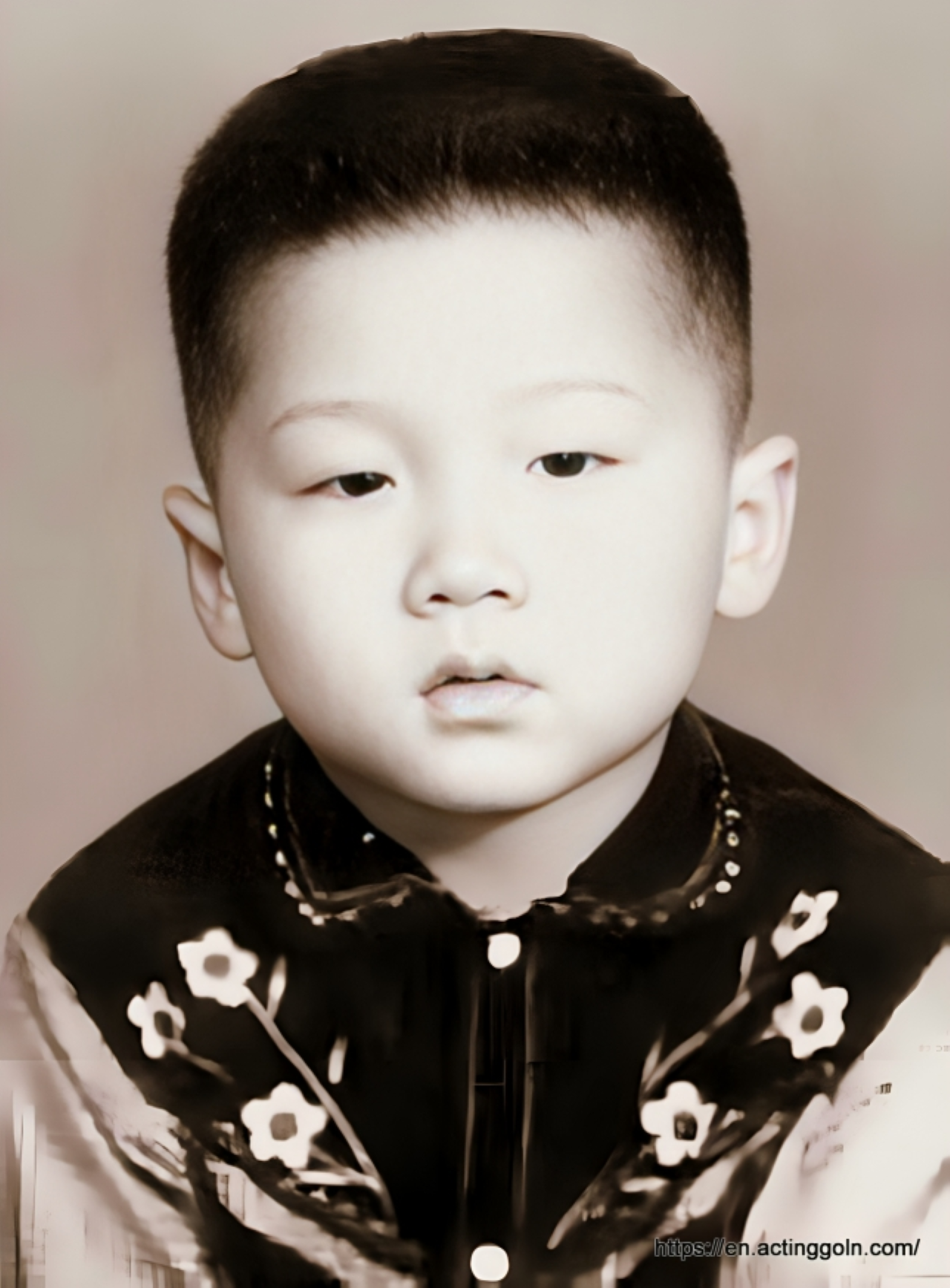 3. The Hospital Became His Second Home!Jackie Chan’s stunts are legendary, but they’ve come at a cost—he has broken nearly every bone in his body at least once! During the filming of Armour of God, he fell from a tree and suffered a serious head injury. Blood came out of his ear, and doctors said he survived miraculously. He now has a plastic plug in his skull as a result of that injury.